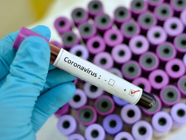 Obvio que coronavirus surgió en un laboratorio chino: Trump.




