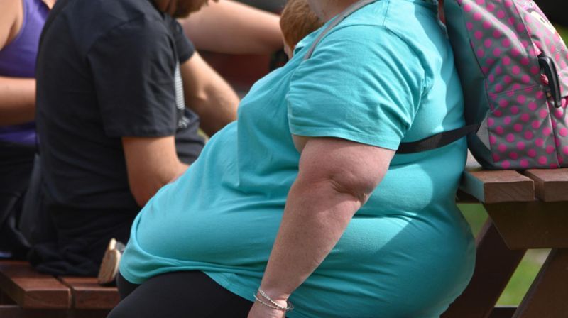 Obesidad genera el doble de posibilidades de agravarse por Covid-19